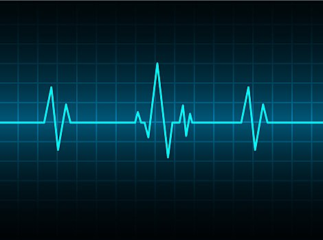 Elektrokardiogramma (EKG)