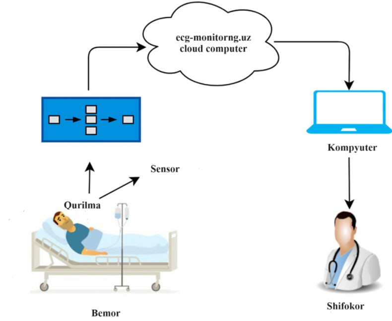 Elektrokardiogramma (EKG)